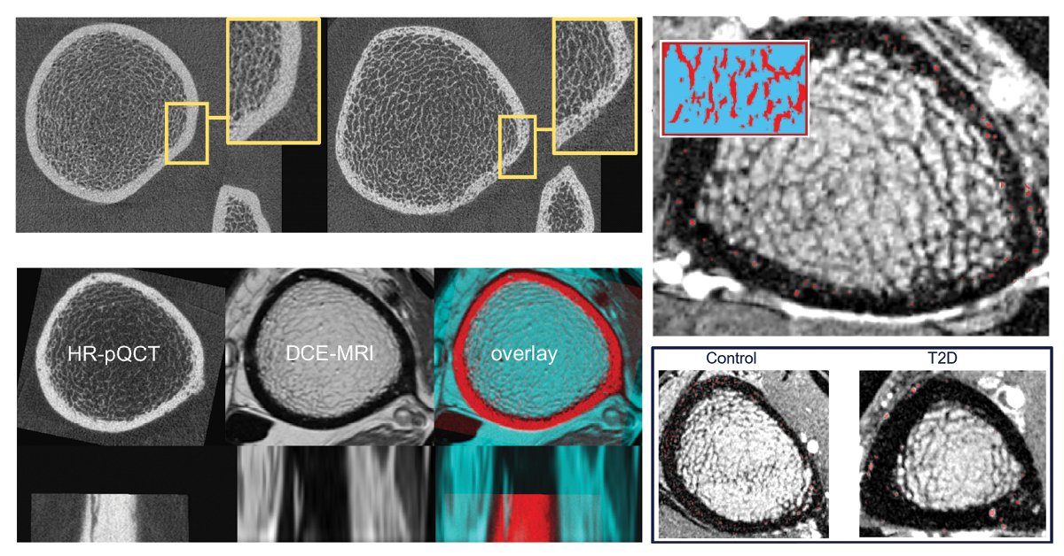 Dual modality bone vasculature imaging. Cellular image of bone density