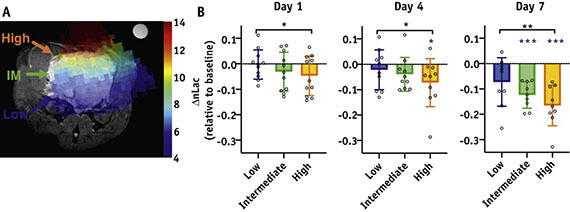 Simultaneous metabolic and perfusion imaging using hyper polarized 13C MRI can evaluate early and dose-dependent responses to prostate cancer radiotherapy