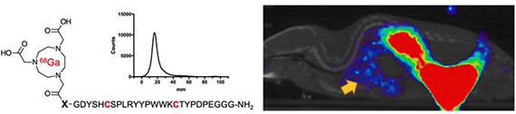 Cyclic gallium-68 labeled peptides for specific detection of human angiotensin converting enzyme
