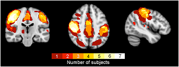 Functional Connectivity (fMRI, MEGI)
