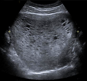 molarpreg.png