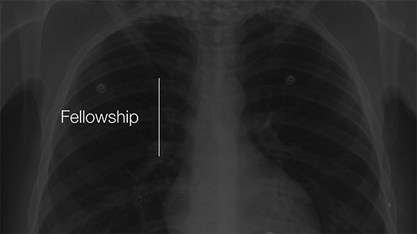 Cardiothoracic Imaging Fellowship