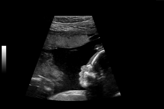 Expedited results at UCSF Montgomery Street