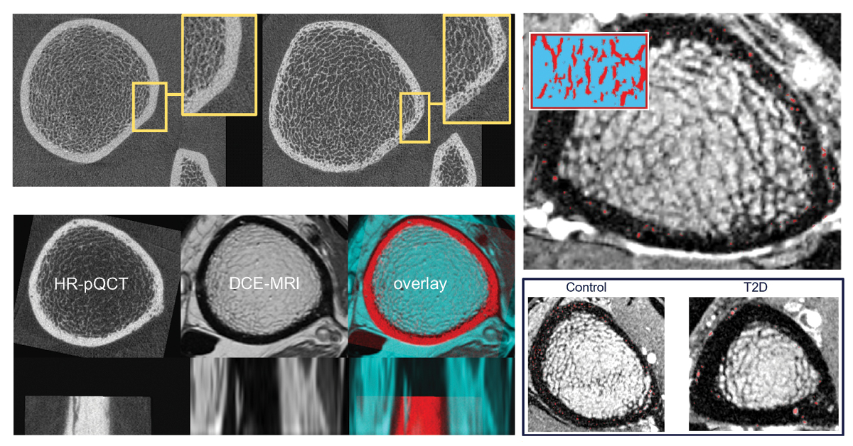 Cellular image of bone density