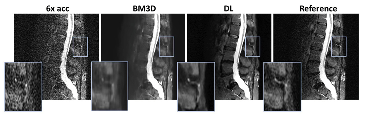 Example of an MRI image from Free.Max