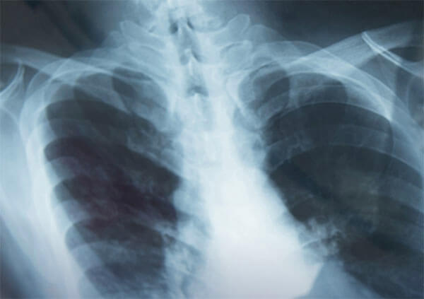 Diagnostic x-ray