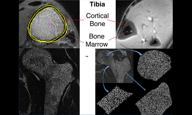 Bone strength - Musculoskeletal Magnetic Resonance Imaging Lab