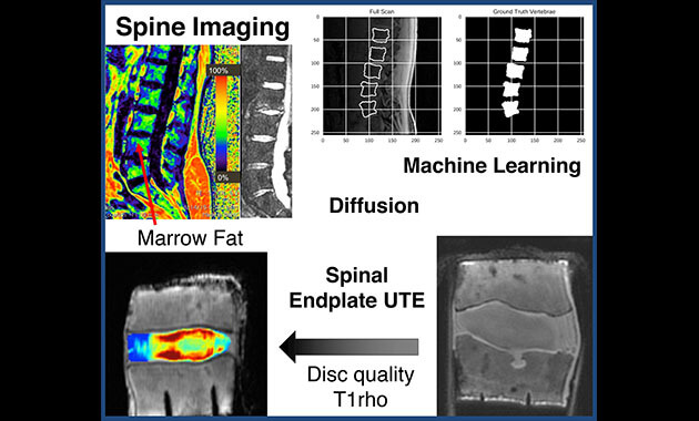 Spine imaging - Musculoskeletal Magnetic Resonance Imaging Lab