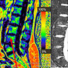 Spine Imaging - Krug Lab