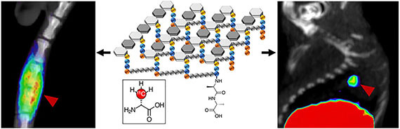 Sensing living bacteria in vivo using D-alanine derived 11C radiotracers