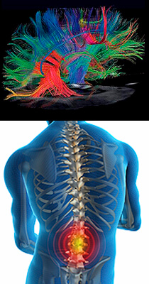 Neuroradiology brain and spine images