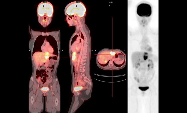 Molecular Imaging and Therapeutics Clinical Section